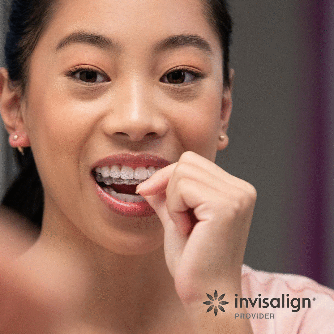Spreckels Park Dental Invisalign Aligners - Clear Orthodontic Treatment