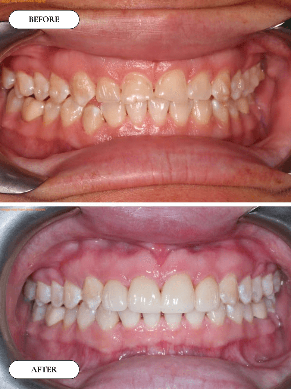 Smile Gallery 3