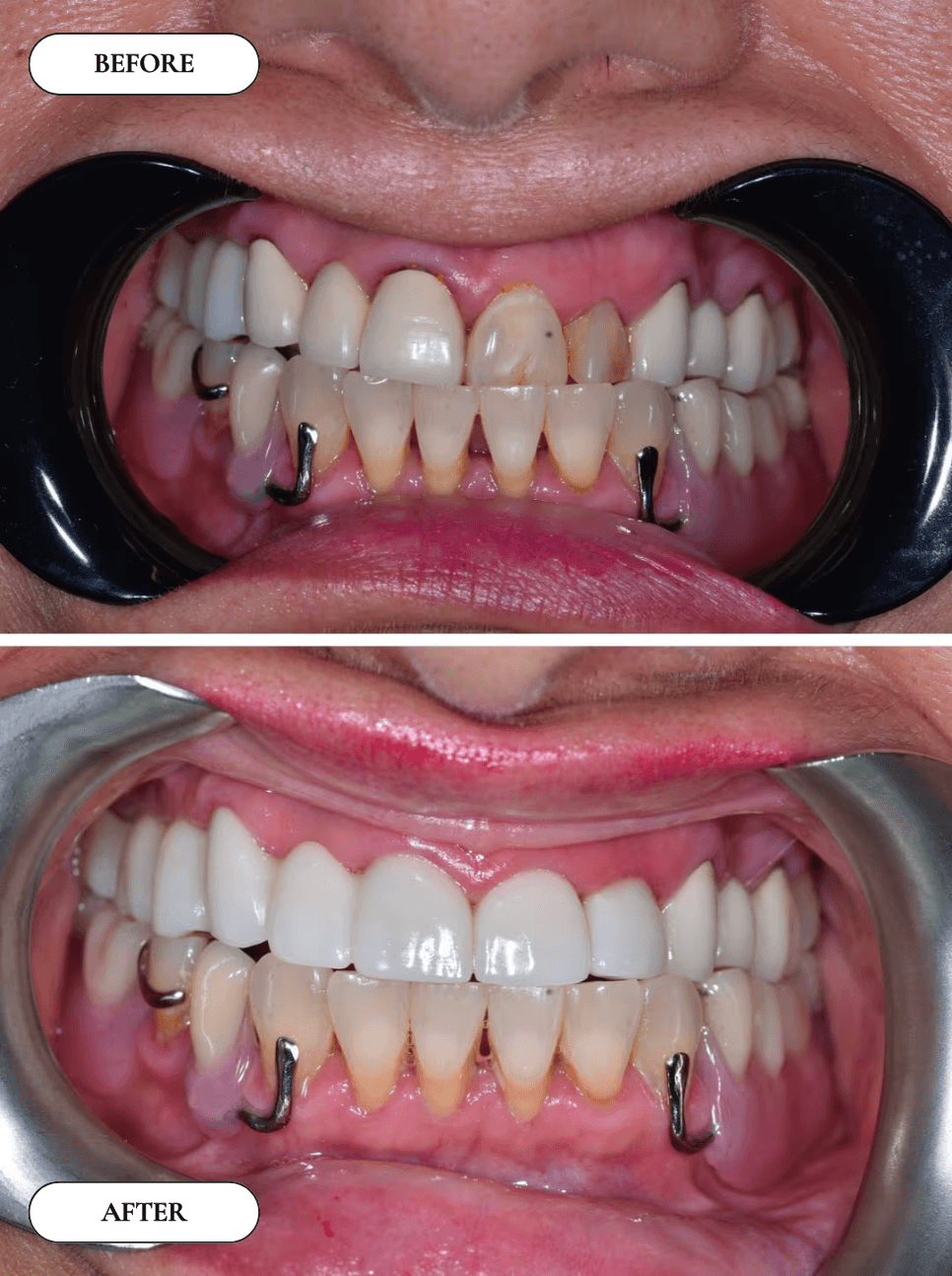 Smile Gallery 4