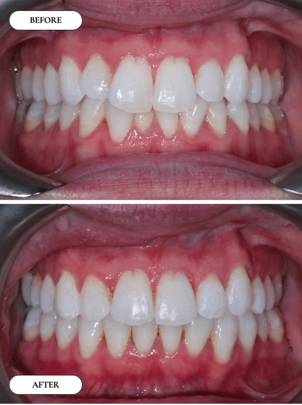Smile Gallery 7