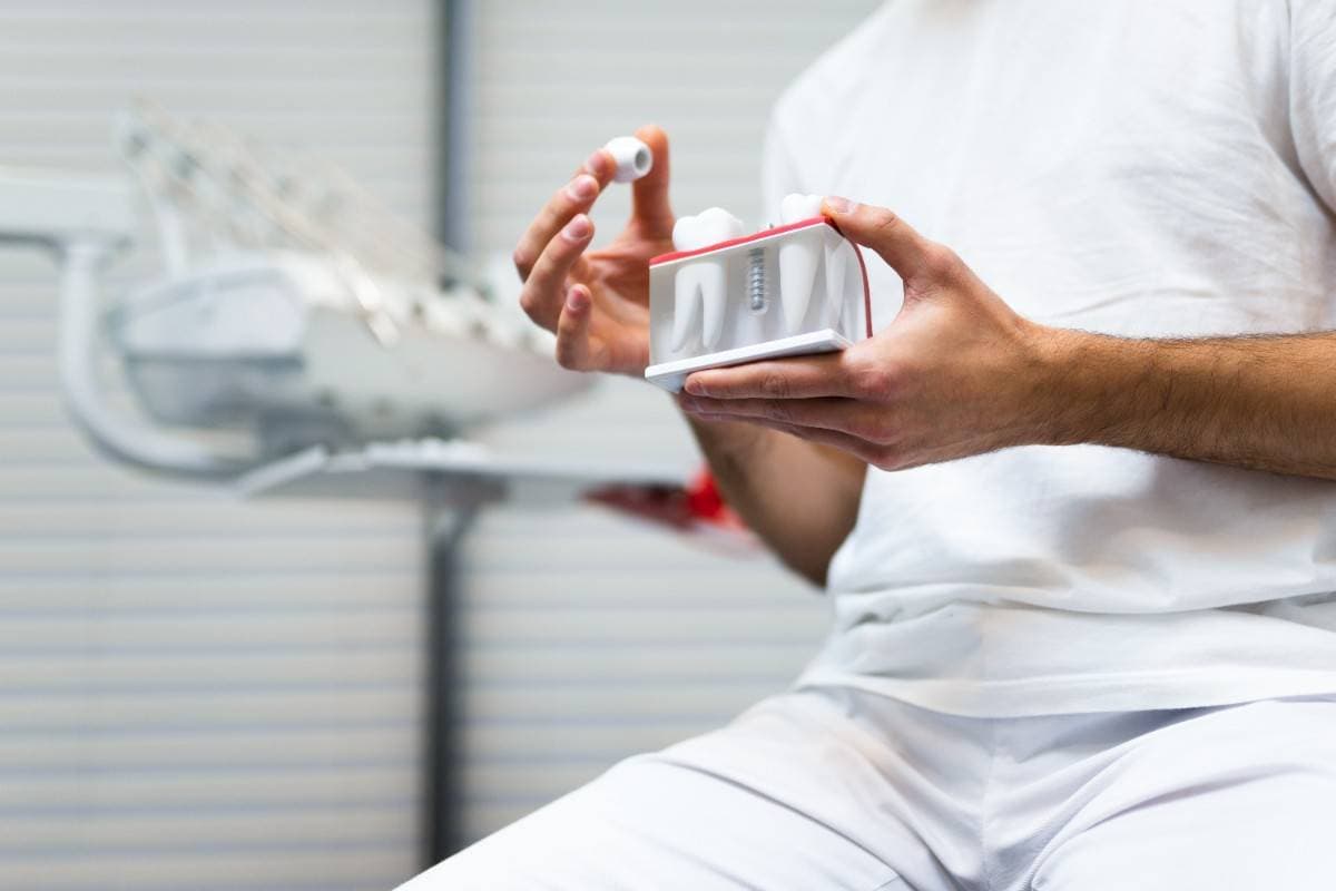 Why choose dental implants in Manteca, California