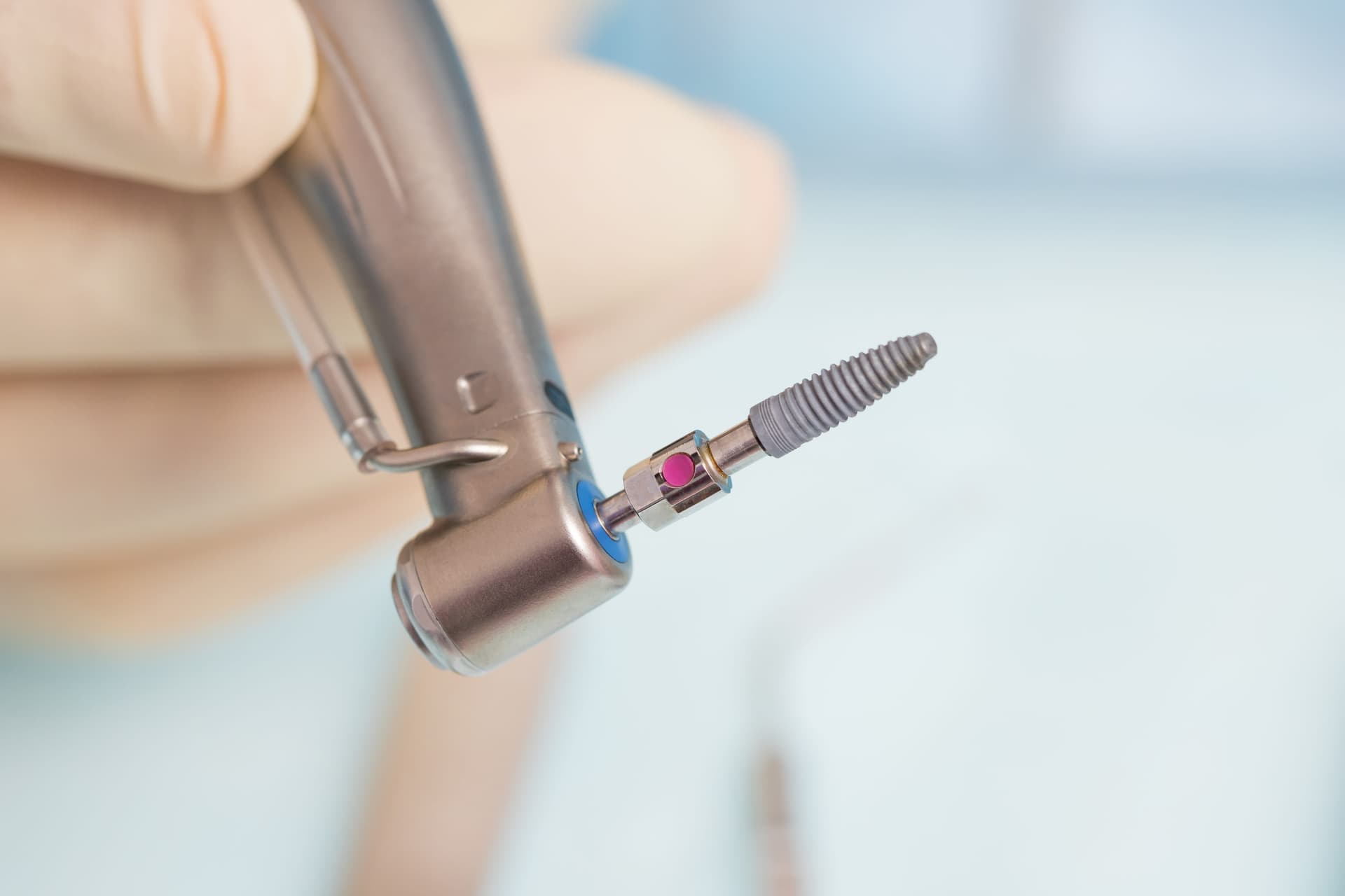 Why Titanium Is the Best Material for Dental Implants: A Scientific Overview